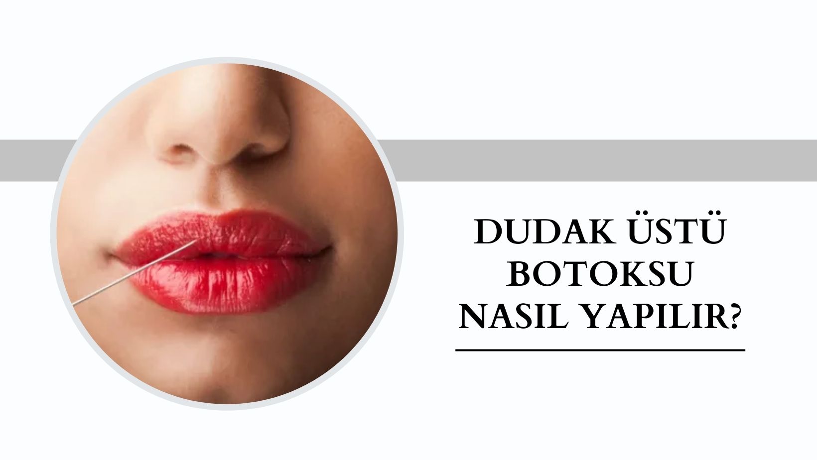 Dudak Üstü Botoksu Nasıl Yapılır
