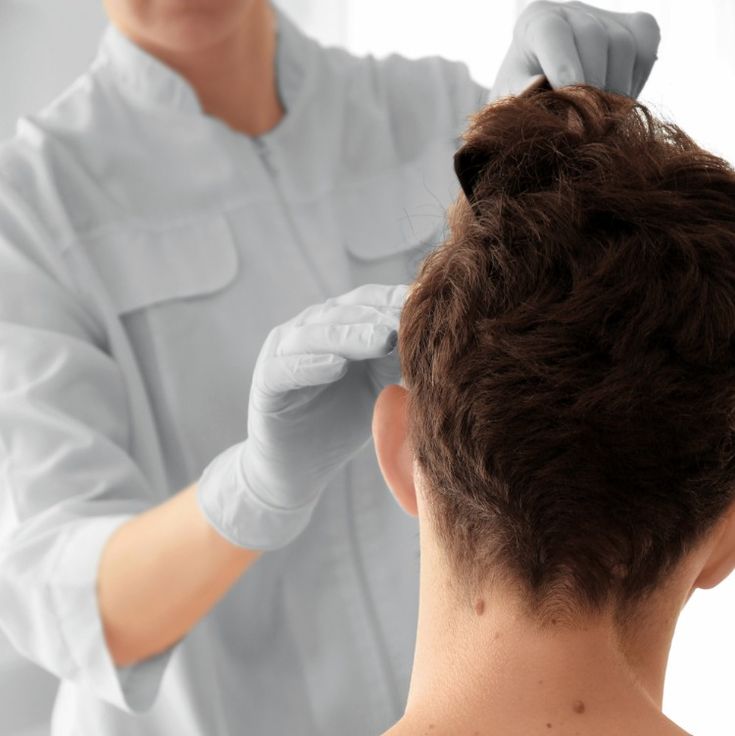 Saç-dökülmesine-doktor-ne-yapar?