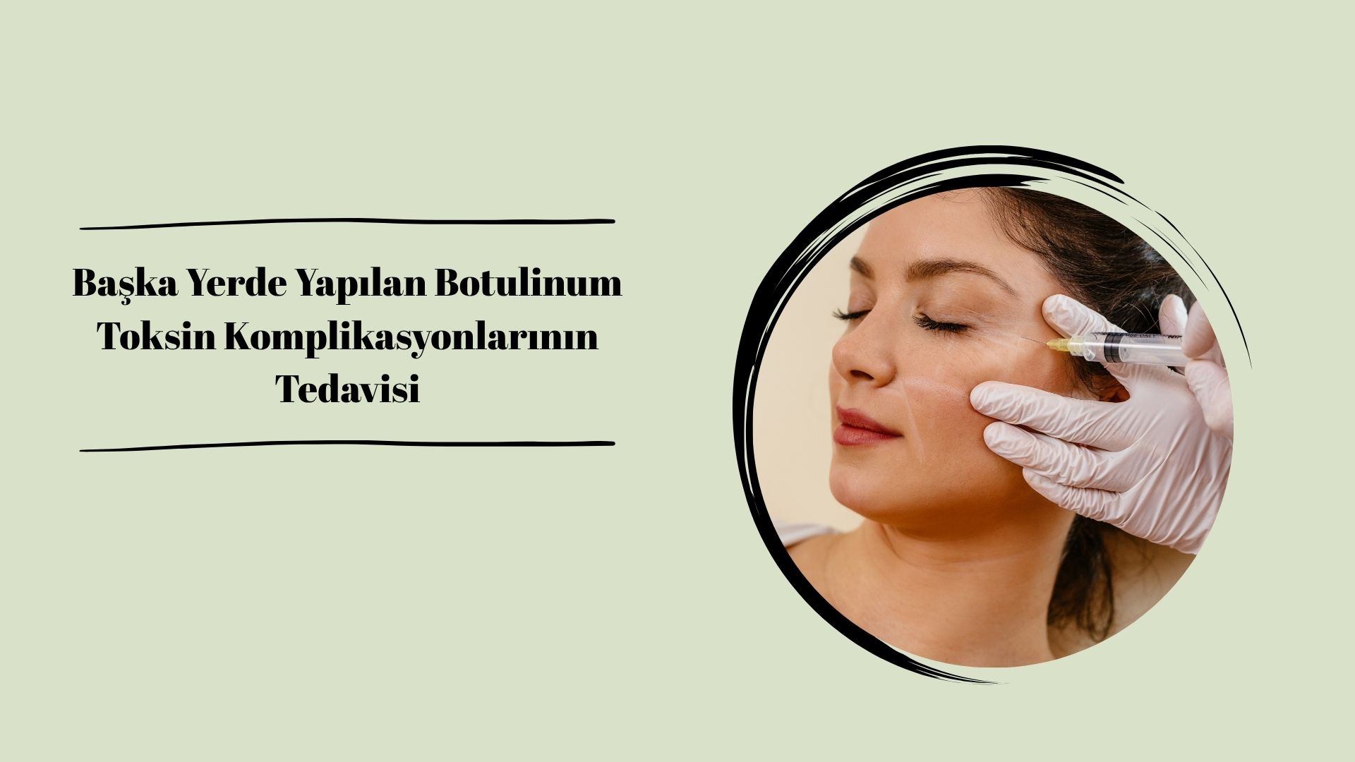 Başka Yerde Yapılan Botulinum Toksin Komplikasyonlarının Tedavisi
