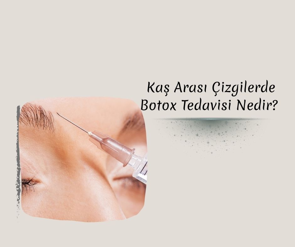 Kaş Arası Çizgilerde Botox Tedavisi Nedir? 