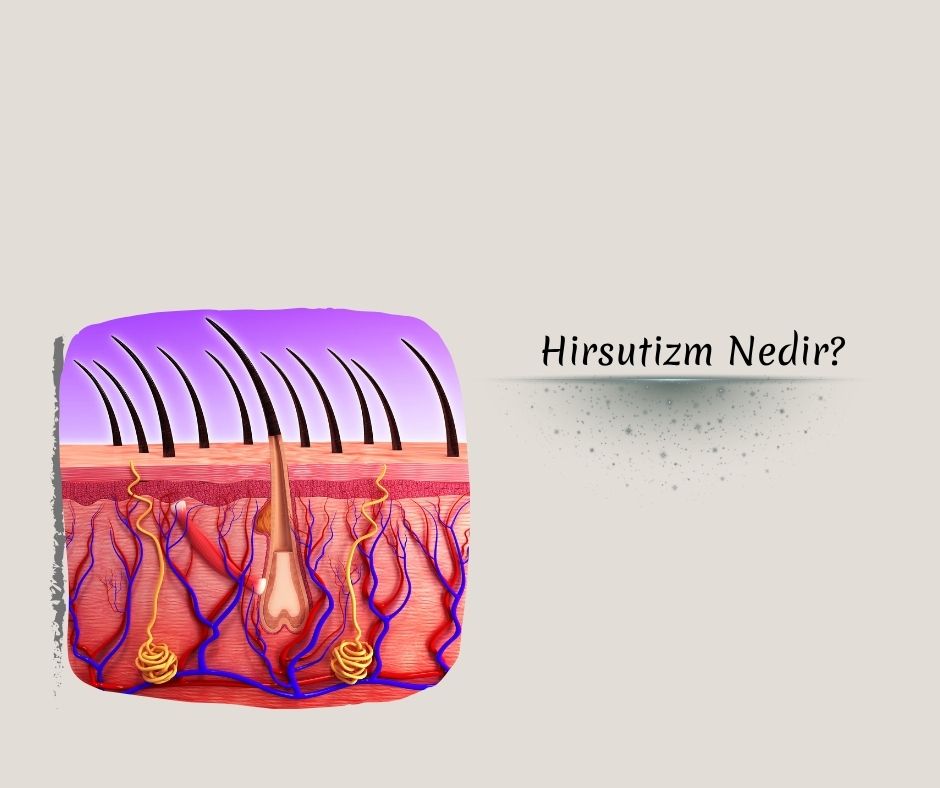  Hirsutizm Nedir?