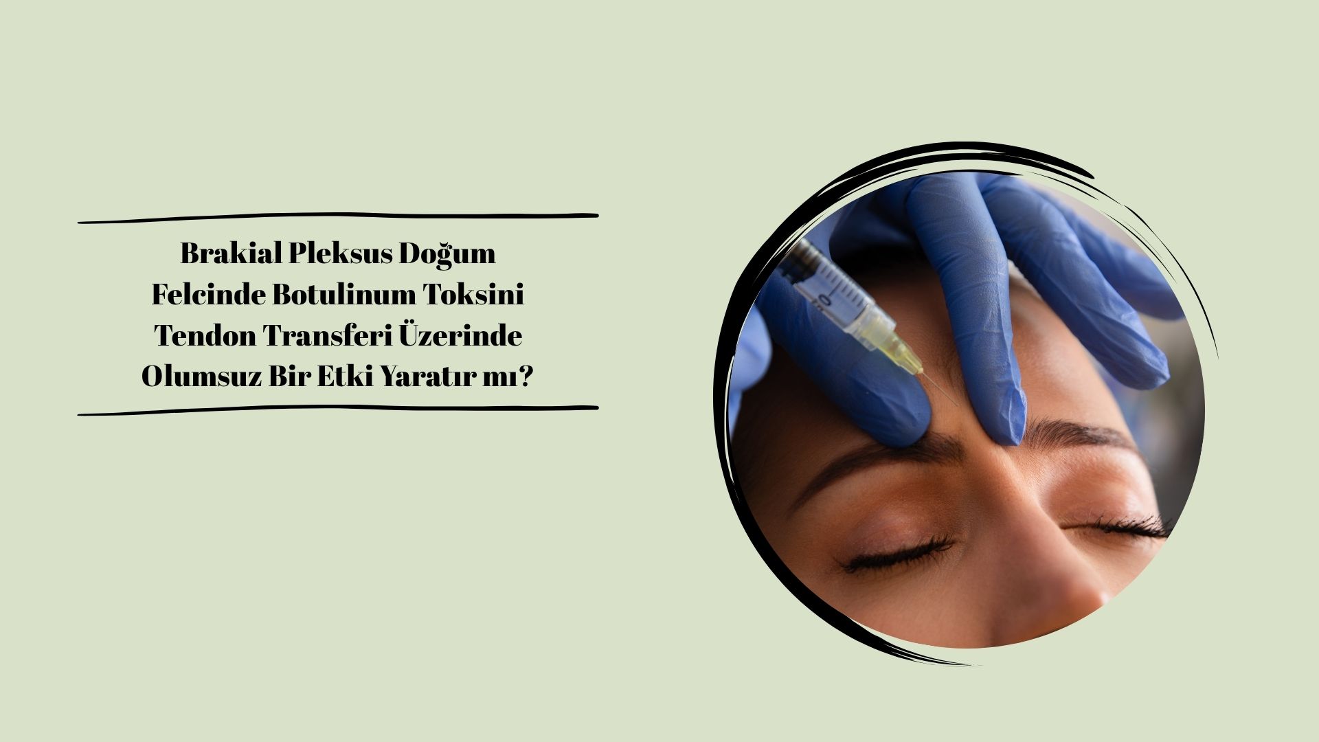 Brakial Pleksus Doğum Felcinde Botulinum Toksini Tendon Transferi Üzerinde Olumsuz Bir Etki Yaratır mı?
