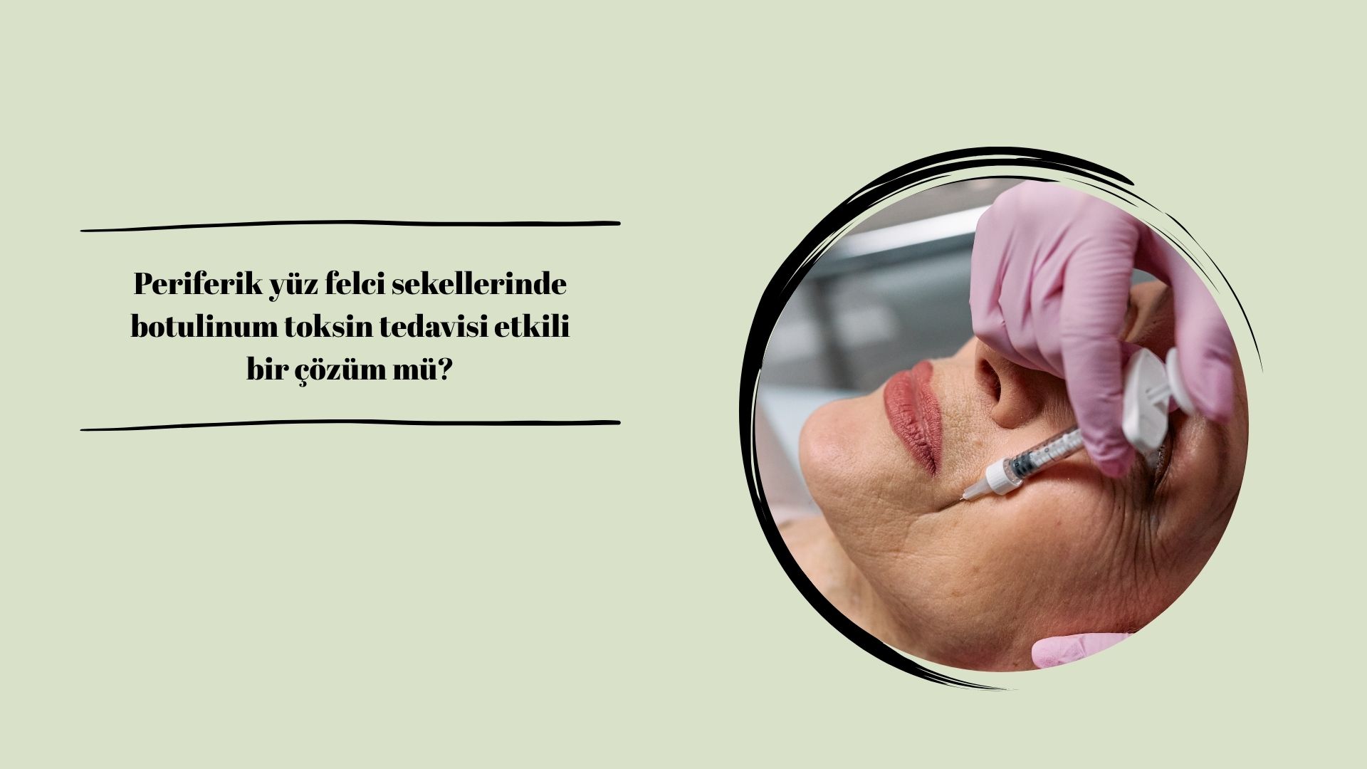 Periferik yüz felci sekellerinde botulinum toksin tedavisi etkili bir çözüm mü?