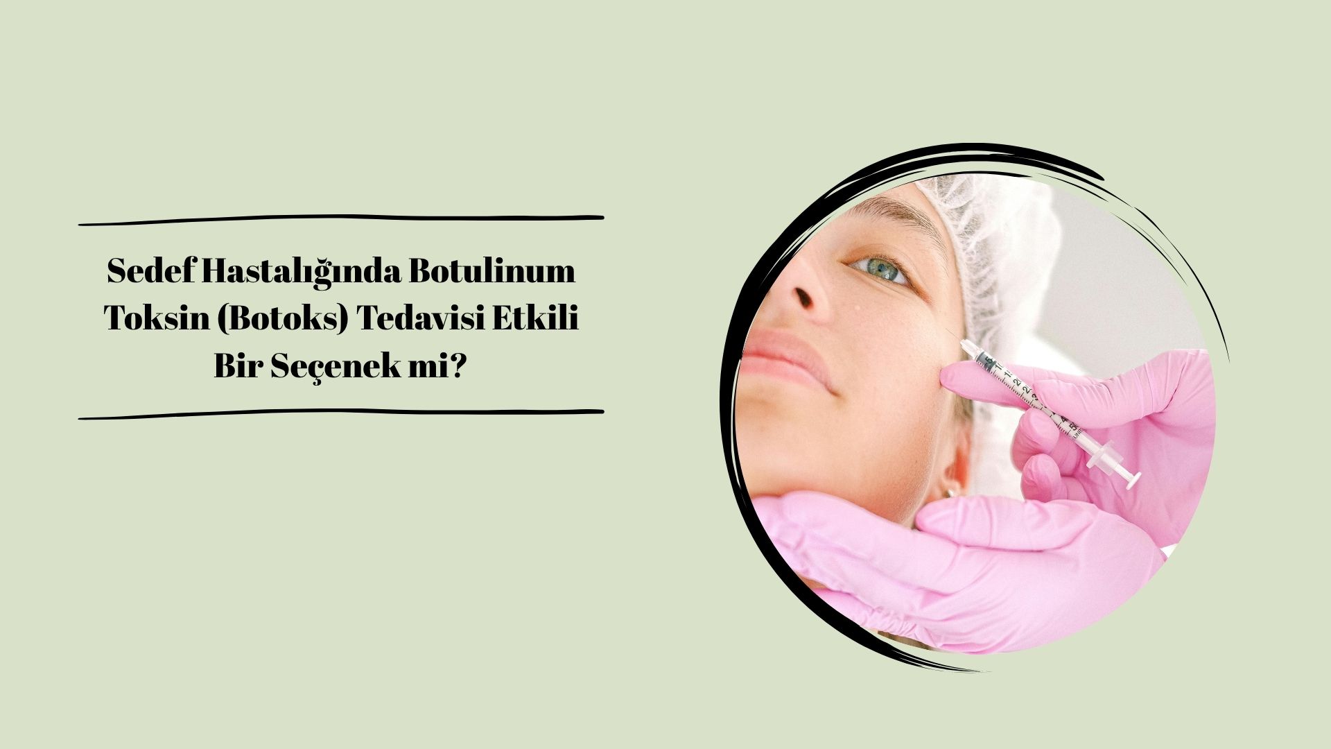 Sedef Hastalığında Botulinum Toksin (Botoks) Tedavisi Etkili Bir Seçenek mi?