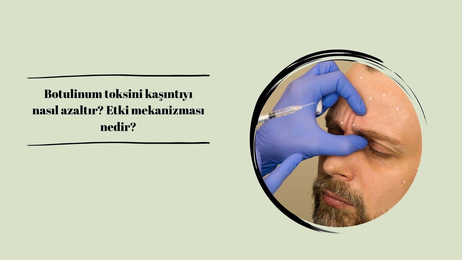 Botulinum toksini kaşıntıyı nasıl azaltır? Etki mekanizması nedir?