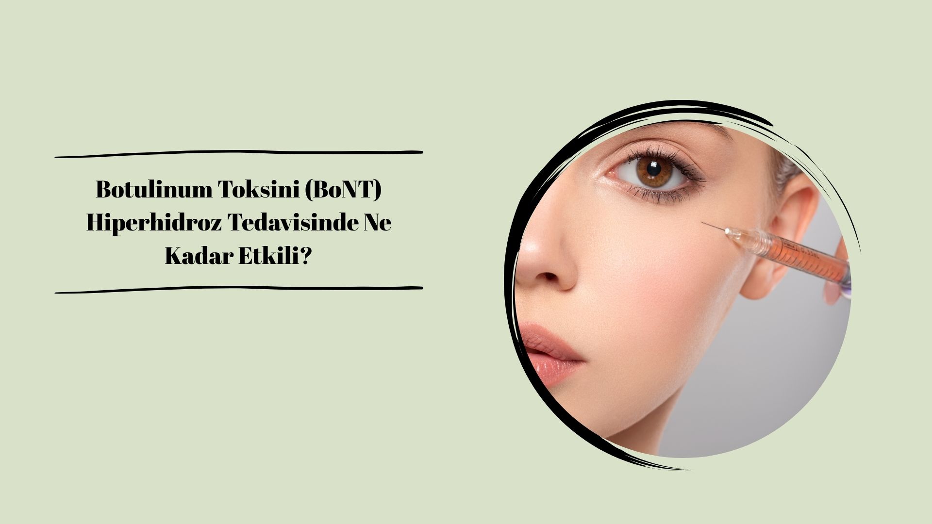 Botulinum Toksini (BoNT) Hiperhidroz Tedavisinde Ne Kadar Etkili?