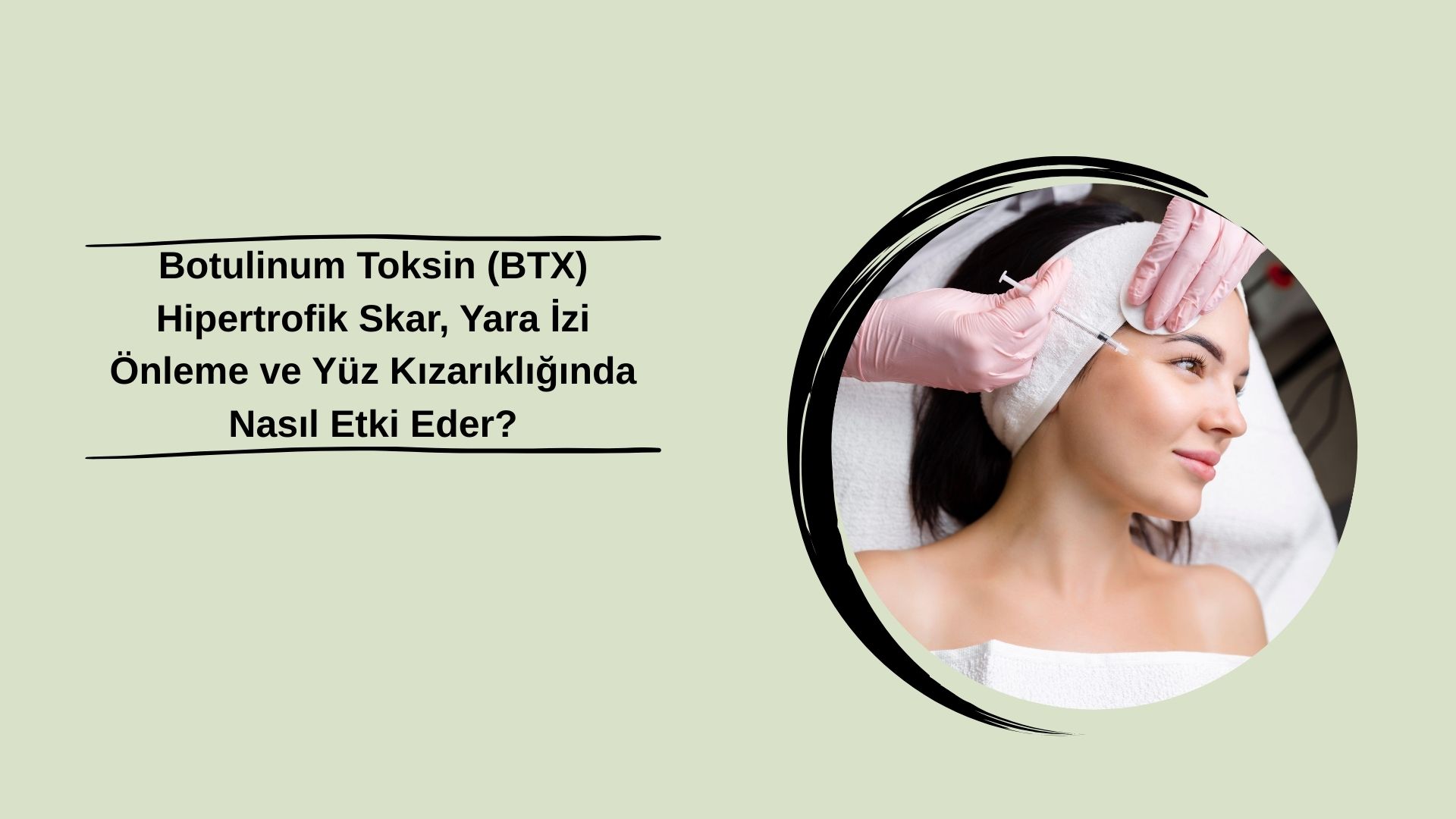 Botulinum Toksin (BTX) Hipertrofik Skar, Yara İzi Önleme ve Yüz Kızarıklığında Nasıl Etki Eder?