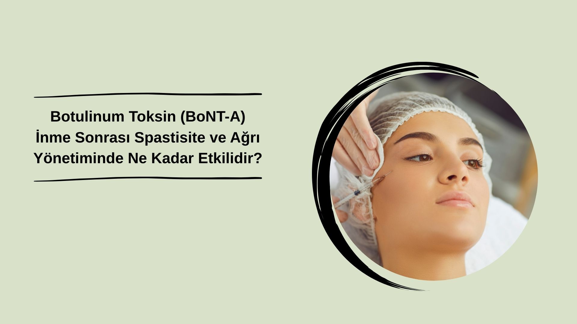 Botulinum Toksin (BoNT-A) İnme Sonrası Spastisite ve Ağrı Yönetiminde Ne Kadar Etkilidir?