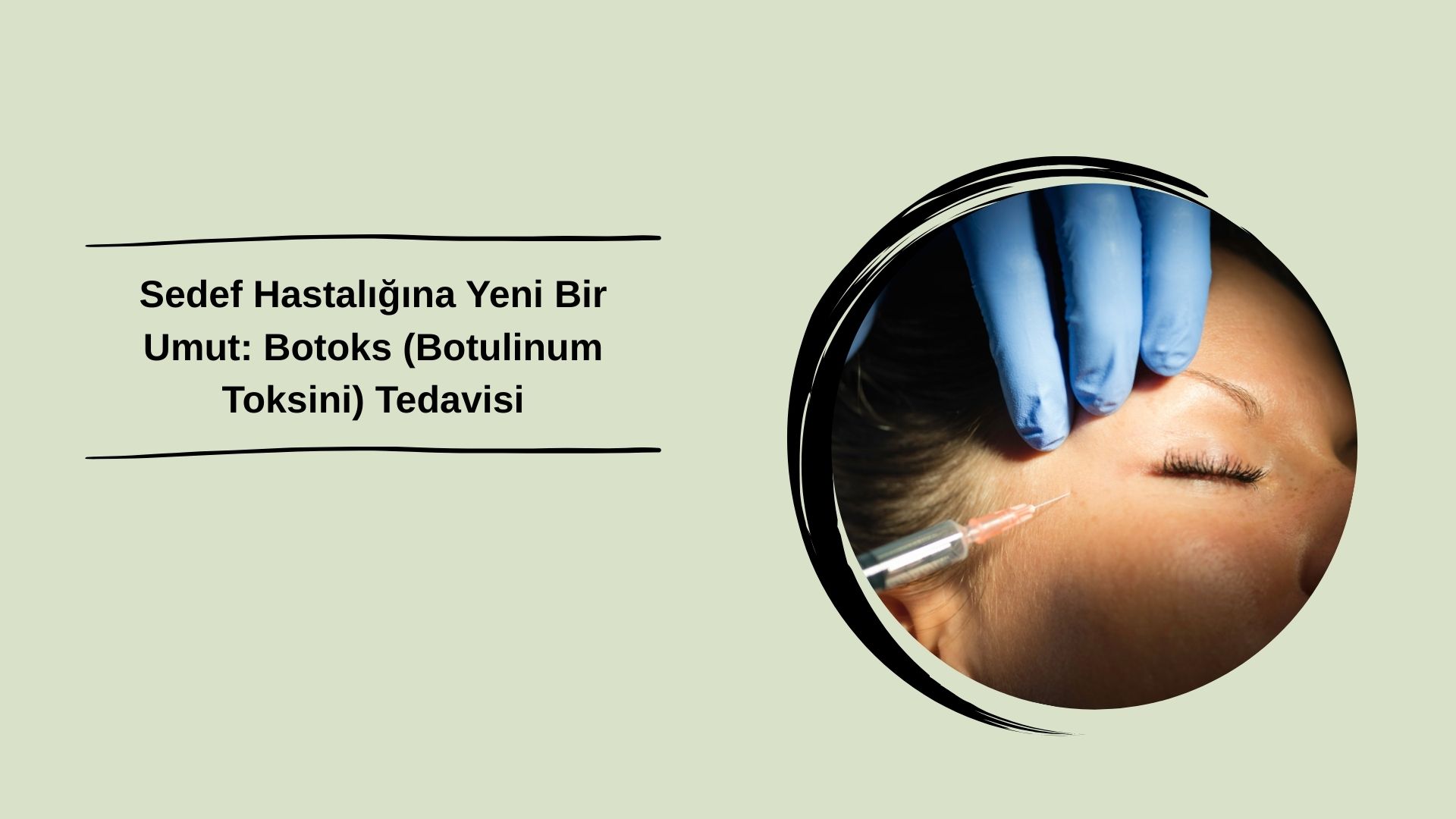 Sedef Hastalığına Yeni Bir Umut: Botoks (Botulinum Toksini) Tedavisi