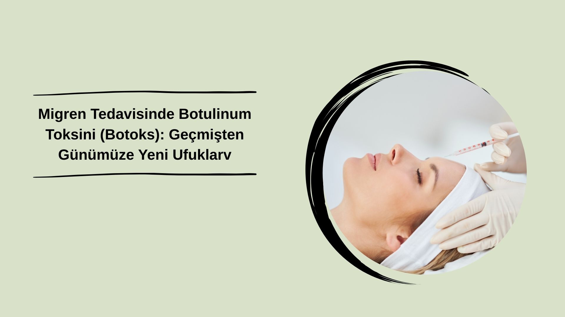 Migren Tedavisinde Botulinum Toksini (Botoks): Geçmişten Günümüze Yeni Ufuklar