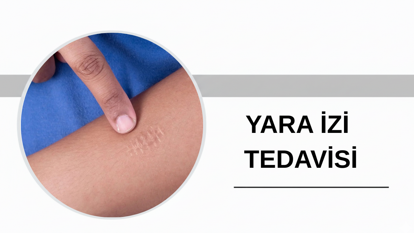 Ankara Yara İzi Tedavisi