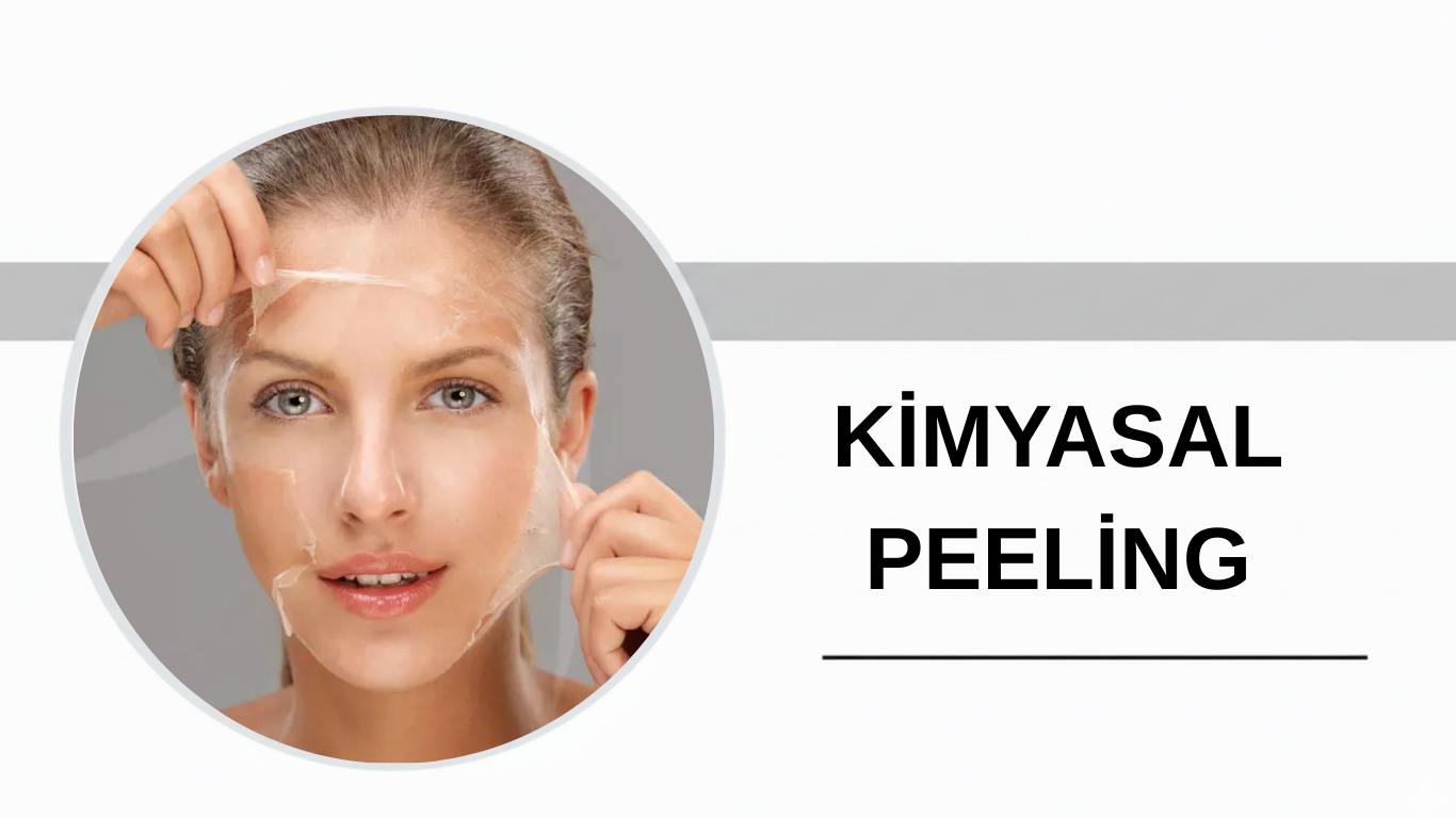 Ankara Kimyasal Peeling