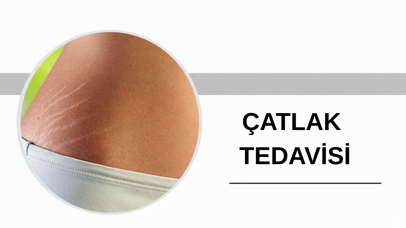 Ankara Çatlak Tedavisi