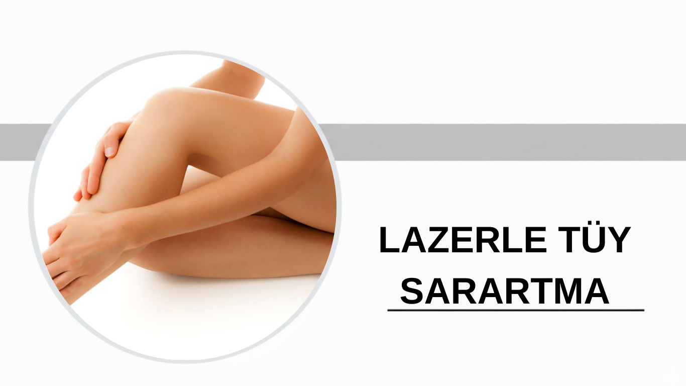 Ankara Lazerle Tüy Sarartma