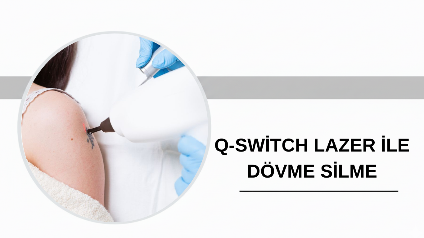 Ankara Q-Switch Lazer ile Dövme Silme