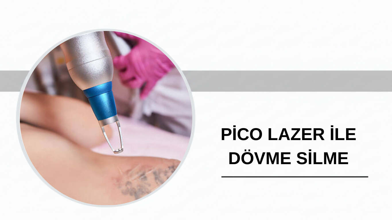 Ankara Pico Lazer ile Dövme Silme