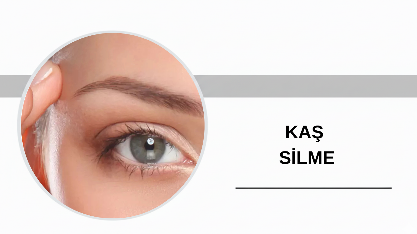 Ankara Kaş Silme