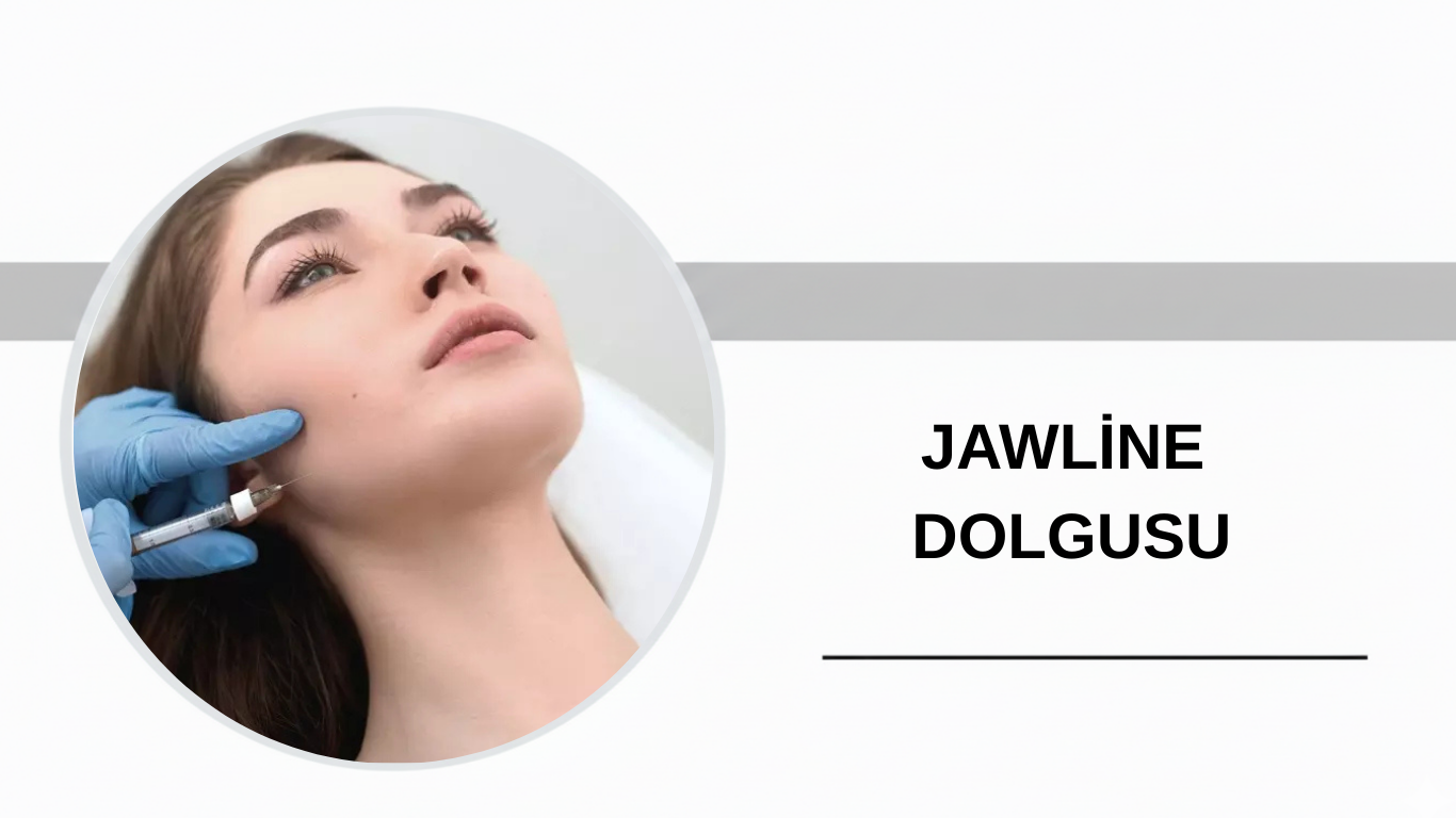 Ankara Jawline Dolgusu
