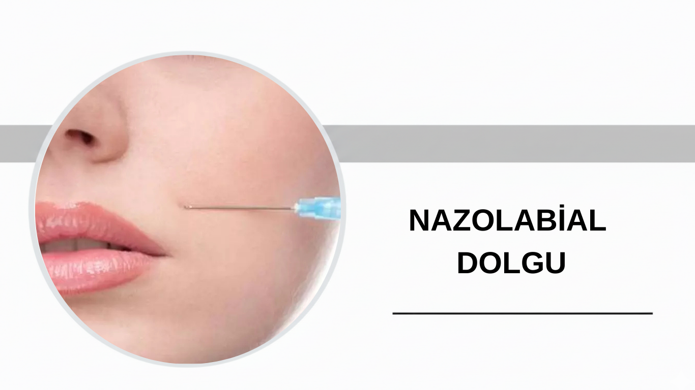 Ankara Nazolabial Dolgu