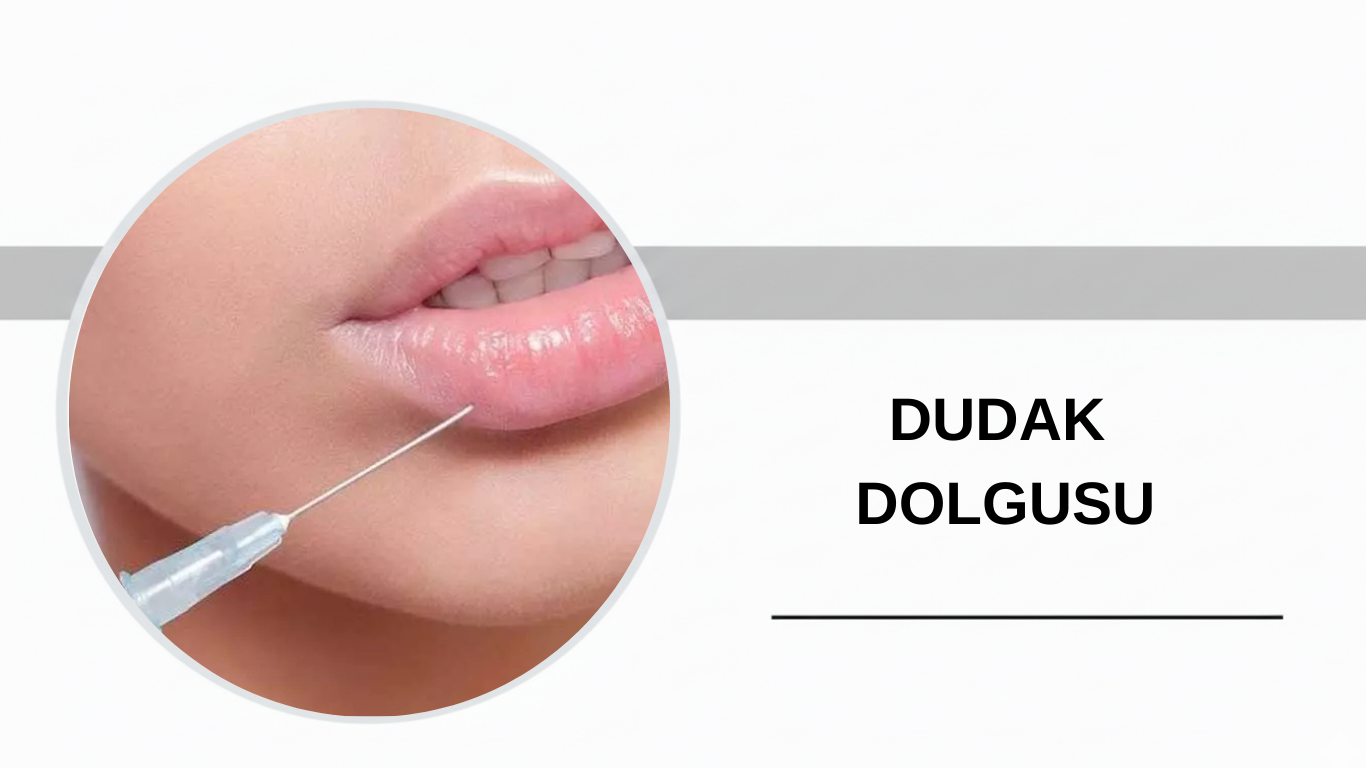 Ankara Dudak Dolgusu