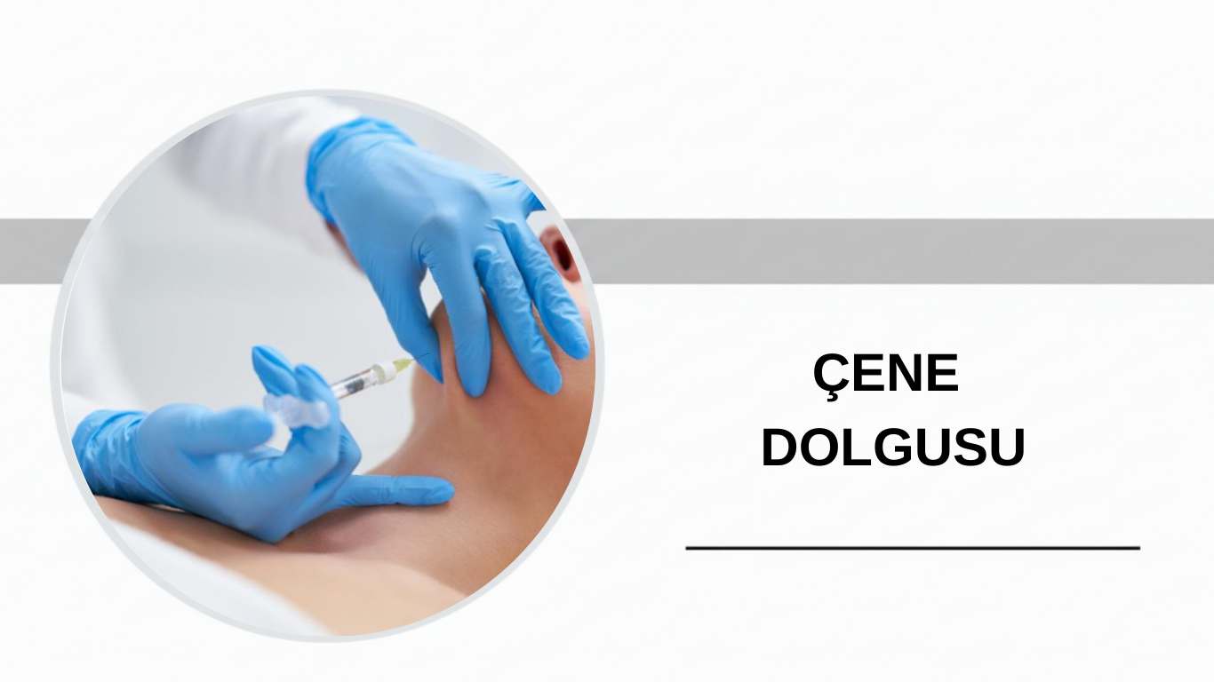 Ankara Çene Dolgusu