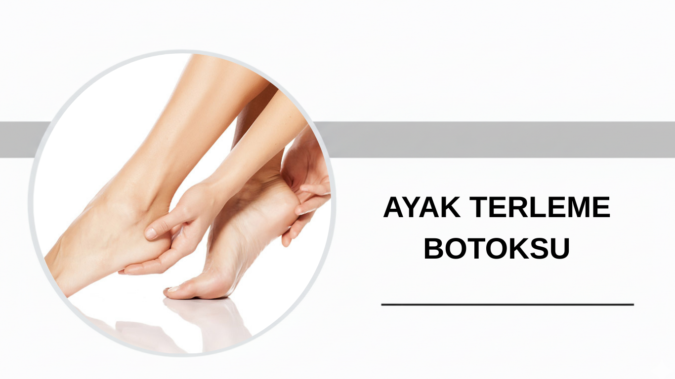 Ankara Ayak Terleme Botoksu