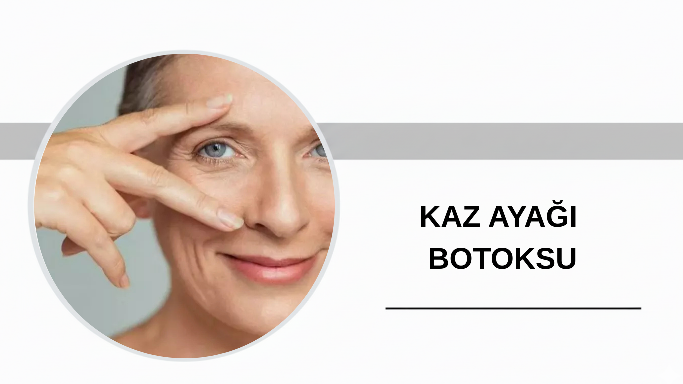 Ankara Kaz Ayağı Botoksu