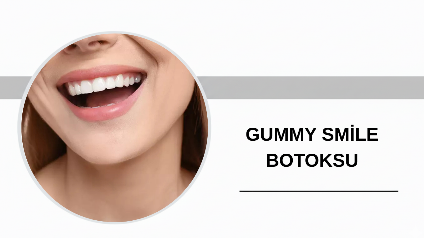 Ankara Gummy Smile Botoksu